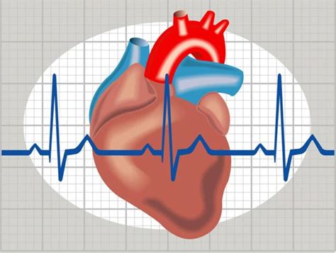 Heart arrhythmia .